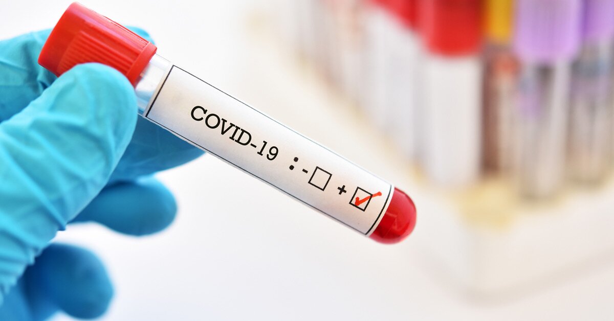 На Черкащині зафіксовано 616 випадків коронавірусної хвороби, – МОЗ